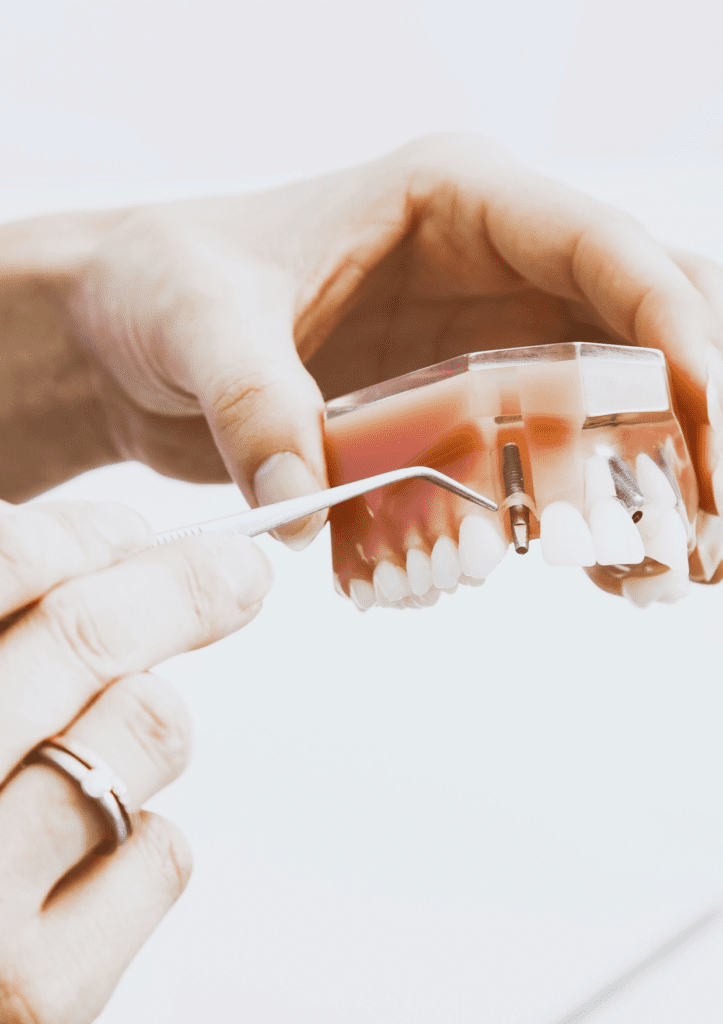 prótesis dentales Sagunto